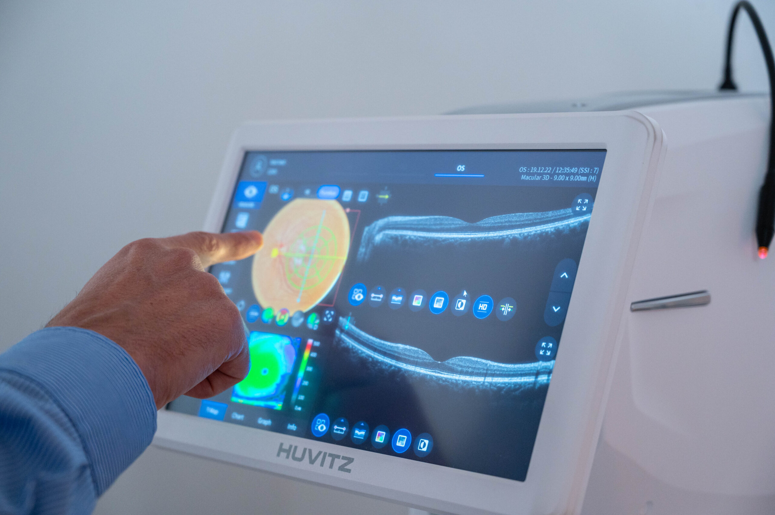 בדיקת OCT | כלי אבחון ומעקב לא פולשני למחלות עיניים