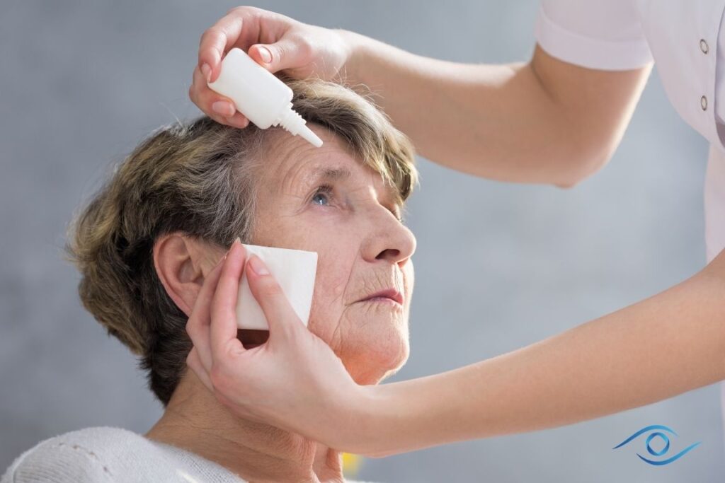 אישה שמה טיפות לטיפול בבצקת לאחר ניתוח קטרקט