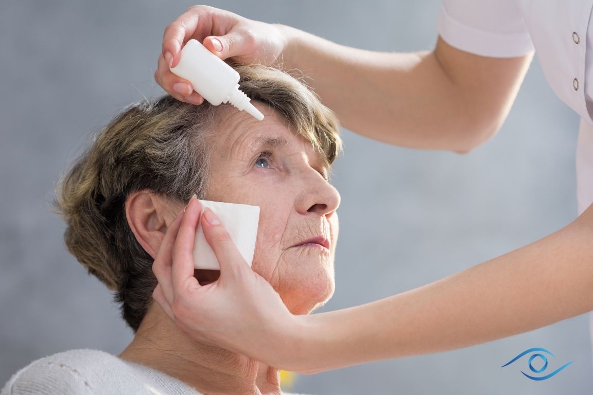 אישה שמה טיפות לטיפול בבצקת לאחר ניתוח קטרקט