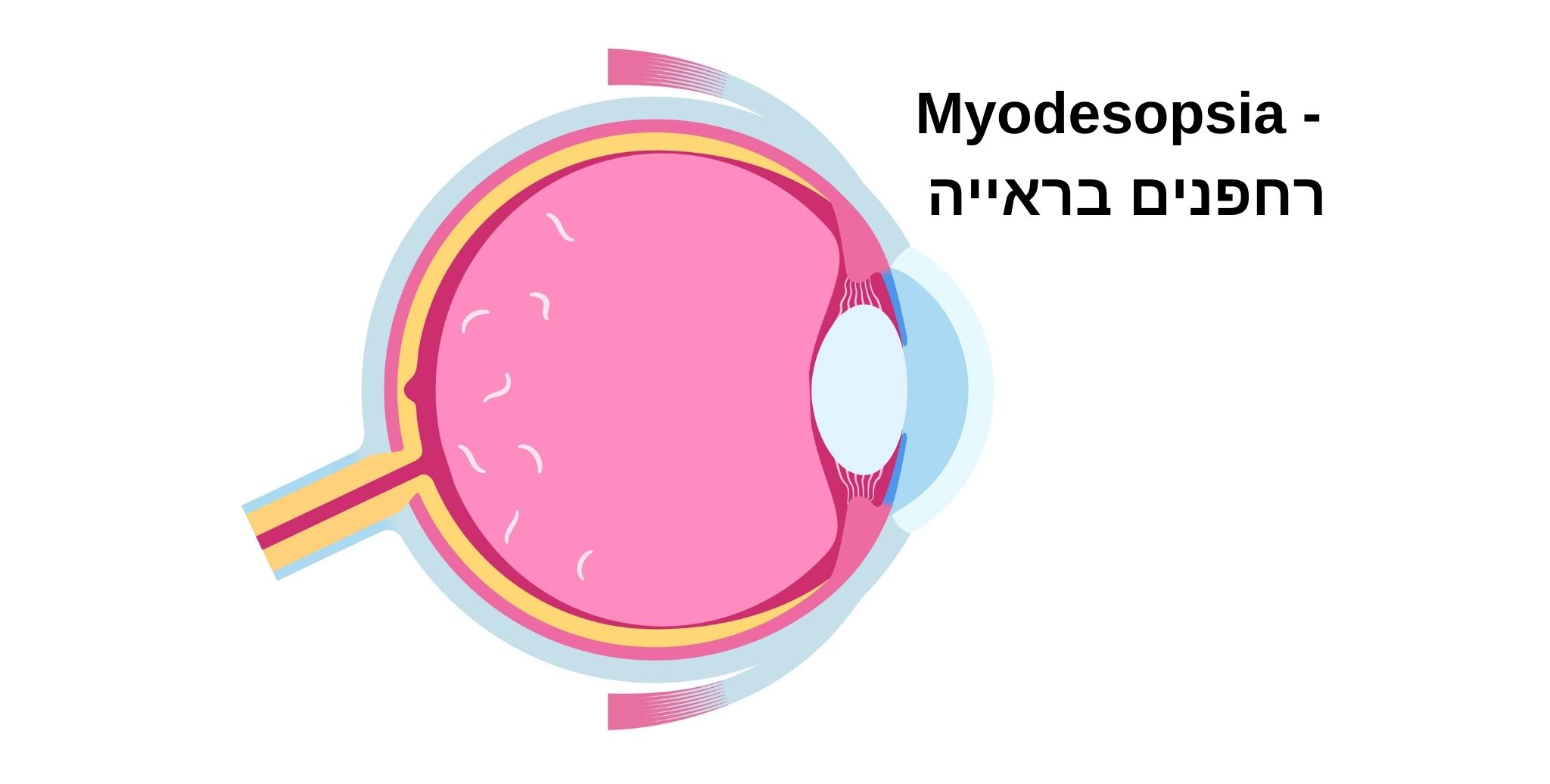 עין עם רחפנים בראייה